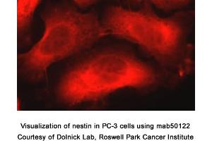 Image no. 1 for anti-Nestin (NES) (AA 1464-1614) antibody (ABIN363276) (Nestin Antikörper  (AA 1464-1614))