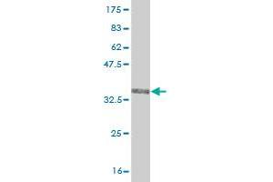 Western Blot detection against Immunogen (35. (TRIM49 Antikörper  (AA 251-340))