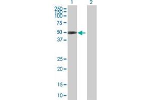 Western Blot analysis of PAX6 expression in transfected 293T cell line by PAX6 MaxPab polyclonal antibody. (PAX6 Antikörper  (AA 1-422))