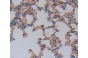 IHC-P analysis of lung tissue, with DAB staining. (NCR1 Antikörper  (AA 17-258))