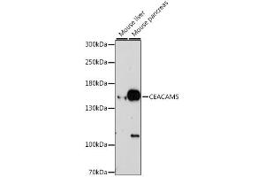 Western blot analysis of extracts of various cell lines, using CEACAM5 antibody (ABIN6291892) at 1:1000 dilution. (CEACAM5 Antikörper)