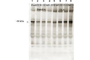 Immunoblotting. (Glycogen Synthase Antikörper  (pSer641))