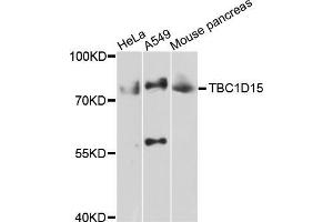 Western blot analysis of extracts of various cell lines, using TBC1D15 antibody (ABIN5999012) at 1/1000 dilution. (TBC1D15 Antikörper)