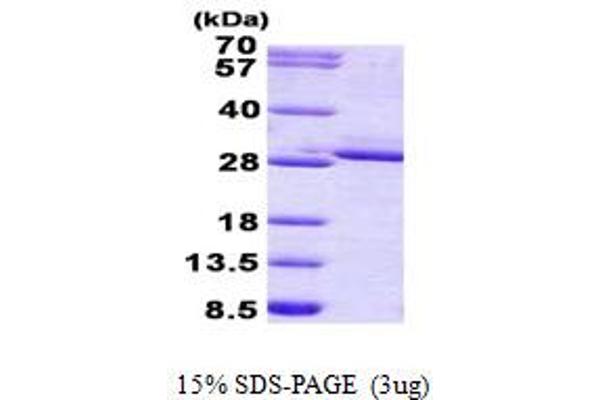 FGF17 Protein (AA 23-216) (His tag)