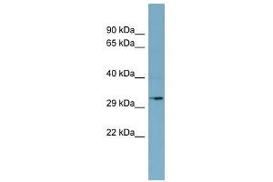 MGC4172 antibody used at 1 ug/ml to detect target protein. (MGC4172 (Middle Region) Antikörper)