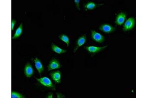 Immunofluorescent analysis of A549 cells using ABIN7149021 at dilution of 1:100 and Alexa Fluor 488-congugated AffiniPure Goat Anti-Rabbit IgG(H+L) (ATG4B Antikörper  (AA 350-400))
