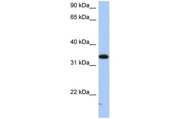 SULT6B1 Antikörper  (C-Term)