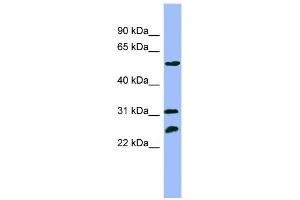 WB Suggested Anti-PSMC4 Antibody Titration: 0. (PSMC4 Antikörper  (N-Term))