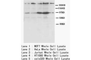 CXCR4 Polyclonal Antibody (CXCR4 Antikörper  (N-Term))