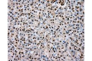 Immunohistochemical staining of paraffin-embedded lung tissue using anti-DAPK2 mouse monoclonal antibody. (DAPK2 Antikörper)