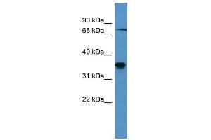 Western Blot showing SH3BP5 antibody used at a concentration of 1-2 ug/ml to detect its target protein. (SH3BP5 Antikörper  (C-Term))