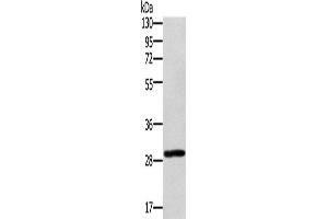 Western Blotting (WB) image for anti-Ectodysplasin A2 Receptor (EDA2R) antibody (ABIN2423351) (Ectodysplasin A2 Receptor Antikörper)