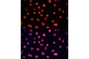 Immunofluorescence analysis of C6 cells using SOX2 Polyclonal Antibody (ABIN6130648, ABIN6148295, ABIN6148297 and ABIN6215241) at dilution of 1:100 (40x lens). (SOX2 Antikörper  (AA 1-140))