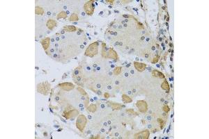 Immunohistochemistry of paraffin-embedded human stomach using ANAPC10 antibody. (ANAPC10 Antikörper  (AA 1-185))