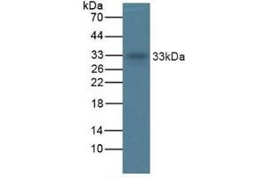 Western Blotting (WB) image for Tryptase alpha/beta 1 (TPSAB1) ELISA Kit (ABIN6574250)