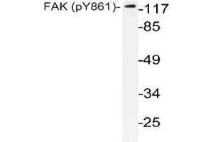 Western blot (WB) analysis of p-FAK antibody in extracts from HeLa cells. (FAK Antikörper  (pTyr861))