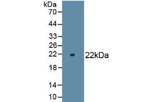 Detection of Recombinant NOS2, Rat using Monoclonal Antibody to Nitric Oxide Synthase 2, Inducible (NOS2) (NOS2 Antikörper  (AA 518-694))