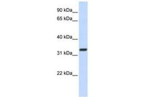 Image no. 1 for anti-NK2 Homeobox 5 (NKX2-5) (AA 72-121) antibody (ABIN6742220) (NK2 Homeobox 5 Antikörper  (AA 72-121))