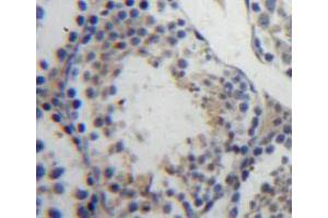 Used in DAB staining on fromalin fixed paraffin-embedded testis tissue (Ubiquitin Hydrolase L3 (AA 2-230) Antikörper)