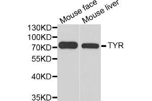 Western blot analysis of extracts of various cell lines, using TYR antibody (ABIN5970593) at 1/1000 dilution. (TYR Antikörper)