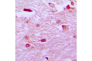 Immunohistochemical analysis of ETV1 staining in human brain formalin fixed paraffin embedded tissue section. (ETV1 Antikörper  (N-Term))