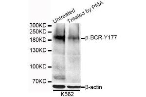Western blot analysis of extracts of K-562 cells, using Phospho-BCR-Y177 antibody (ABIN5995631) at 1/1000 dilution. (BCR Antikörper  (pTyr177))