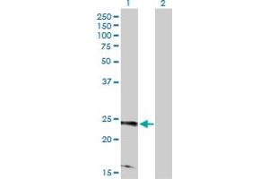 Western Blot analysis of RRAS2 expression in transfected 293T cell line by RRAS2 MaxPab polyclonal antibody. (RRAS2 Antikörper  (AA 1-204))
