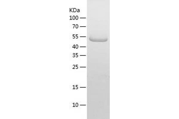 MEF2A Protein (AA 1-499) (His tag)