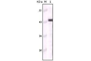 Western Blot showing CK5 antibody used against truncated CK5 recombinant protein (Cytokeratin 5 Antikörper)