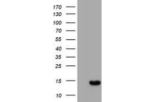 Image no. 1 for anti-Chromosome 17 Open Reading Frame 37 (C17orf37) antibody (ABIN1501782) (C17orf37 Antikörper)