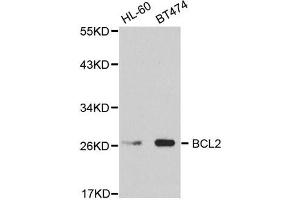 Western Blotting (WB) image for anti-B-Cell CLL/lymphoma 2 (BCL2) antibody (ABIN1876758) (Bcl-2 Antikörper)