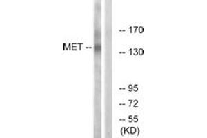 Western blot analysis of extracts from HepG2 cells, using Met (Ab-1349) Antibody. (c-MET Antikörper  (AA 1316-1365))