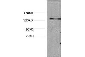 Western blot analysis of Hela, diluted at 1:1000. (COL3 Antikörper)