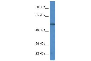 WB Suggested Anti-CAMK4 Antibody Titration: 1. (CAMK4 Antikörper  (C-Term))
