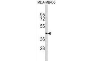 Western Blotting (WB) image for anti-Phytanoyl-CoA 2-Hydroxylase (PHYH) antibody (ABIN3003880) (PHYH Antikörper)