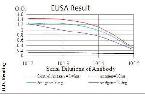 Black line: Control Antigen (100 ng), Purple line: Antigen(10 ng), Blue line: Antigen (50 ng), Red line: Antigen (100 ng), (Calretinin Antikörper  (AA 1-271))