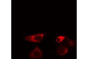 ABIN6274576 staining HeLa cells by IF/ICC. (Serotonin Receptor 5A Antikörper  (Internal Region))