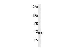 Western blot analysis in CEM cell line lysates (35ug/lane). (DVL2 Antikörper  (C-Term))