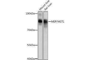 Western blot analysis of extracts of various cell lines, using MSP/MST1 Rabbit mAb (ABIN1680891, ABIN1680890, ABIN3015057 and ABIN3015058) at 1:1000 dilution. (MST1 Antikörper)