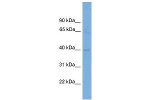 Human ACHN; WB Suggested Anti-CNTD1 Antibody Titration: 0. (CNTD1 Antikörper  (N-Term))