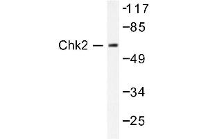Image no. 1 for anti-Checkpoint Kinase 2 (CHEK2) antibody (ABIN271879) (CHEK2 Antikörper)