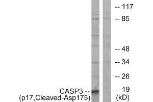 Western blot analysis of extracts from COLO cells, using CASP3 (p17, Cleaved-Asp175) antibody. (Caspase 3 Antikörper  (Cleaved-Asp175))