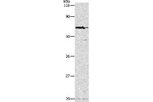 Western blot analysis of Hela cell, using PKM2 Polyclonal Antibody at dilution of 1:500 (PKM Antikörper)