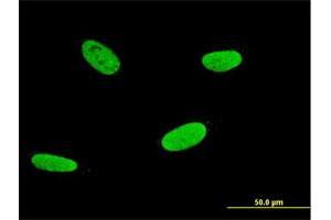 Immunofluorescence (IF) image for anti-Runt-Related Transcription Factor 2 (RUNX2) (AA 251-350) antibody (ABIN560185)