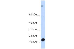 C6ORF201 antibody used at 1 ug/ml to detect target protein. (C6orf201 Antikörper  (N-Term))