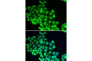 Immunofluorescence analysis of HeLa cells using ERCC2 antibody (ABIN5973287). (ERCC2 Antikörper)