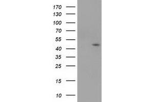 Image no. 1 for anti-serpin Peptidase Inhibitor, Clade B (Ovalbumin), Member 4 (SERPINB4) antibody (ABIN1500889) (SERPINB4 Antikörper)
