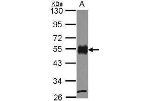 WB Image Sample (30 ug of whole cell lysate) A: JurKat 10% SDS PAGE CD2 antibody antibody diluted at 1:1000 (CD2 Antikörper  (C-Term))