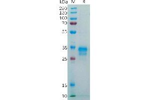 Human F Protein, His Tag on SDS-PAGE under reducing condition. (FOLR1 Protein (AA 25-234) (His tag))