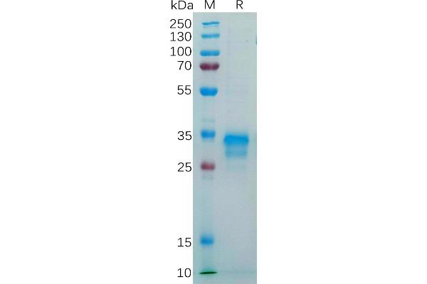 FOLR1 Protein (AA 25-234) (His tag)